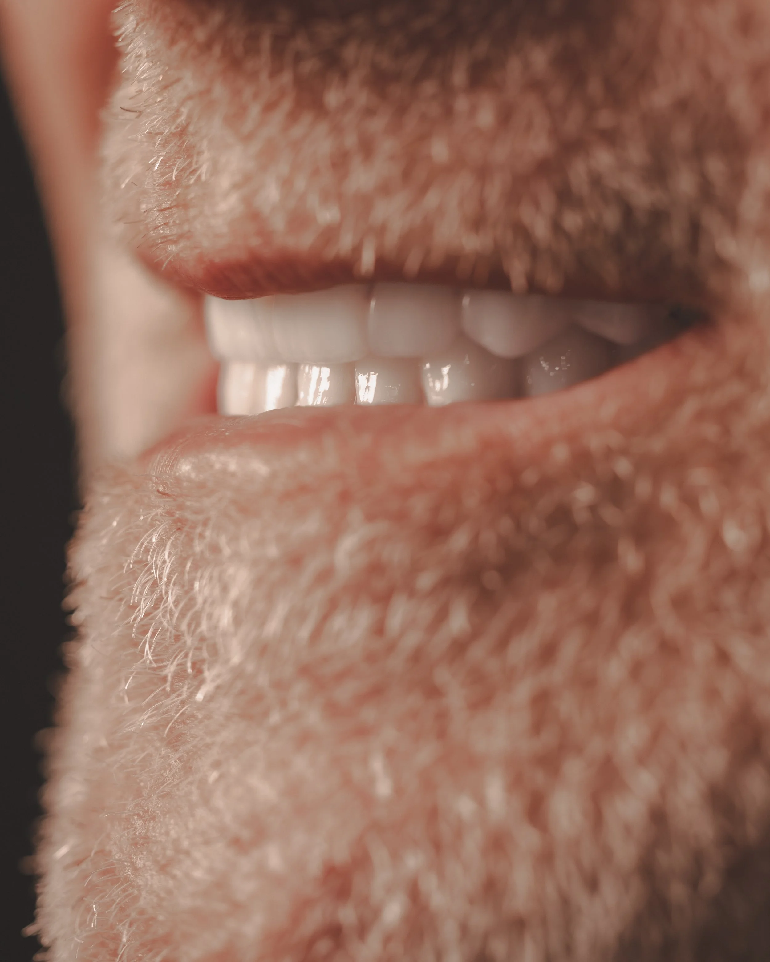 Patient Full Arch Implants Close Up