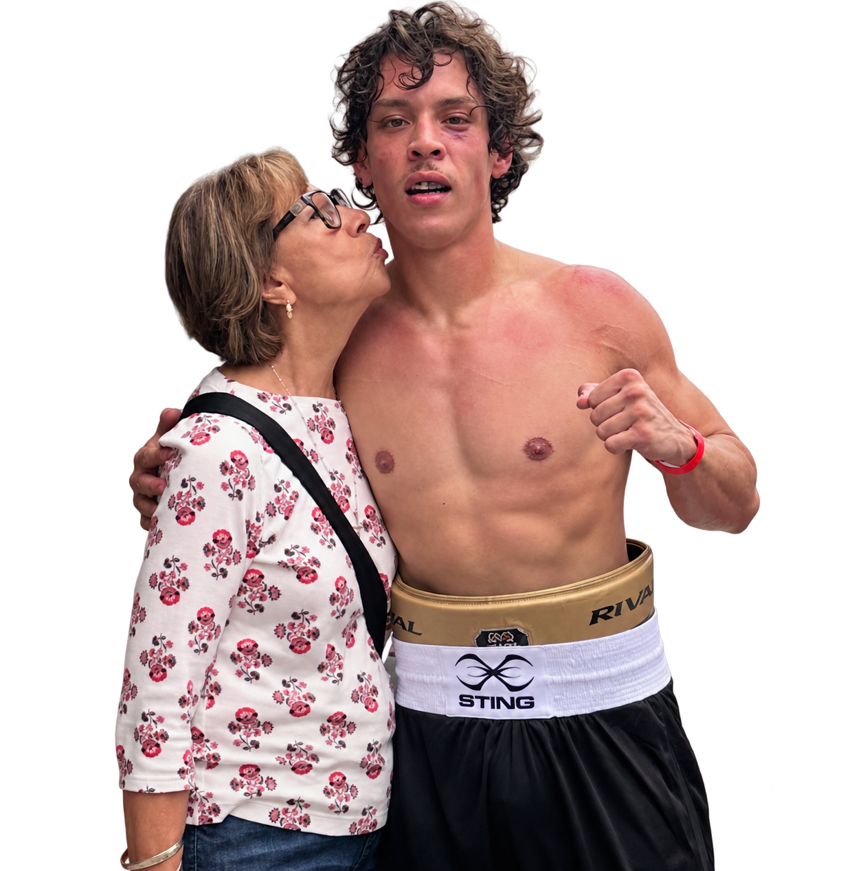 A shirtless male boxer with a bruised eye, wearing boxing shorts, receives a kiss from an older woman wearing glasses and a floral blouse.
