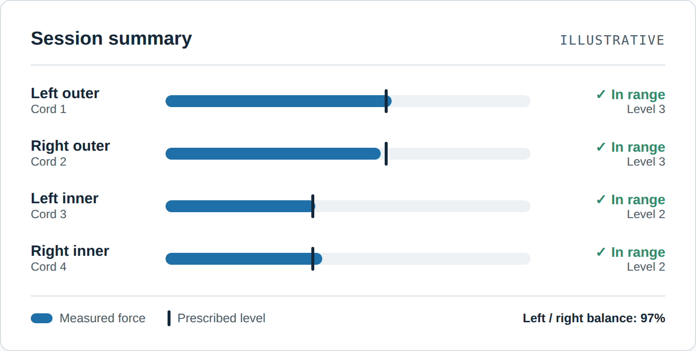 Illustration of the planned monitoring app: measured resistance for four cords compared with the prescribed level