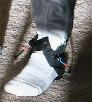Rion's Belt prototype ankle strap anchoring the resistance cords