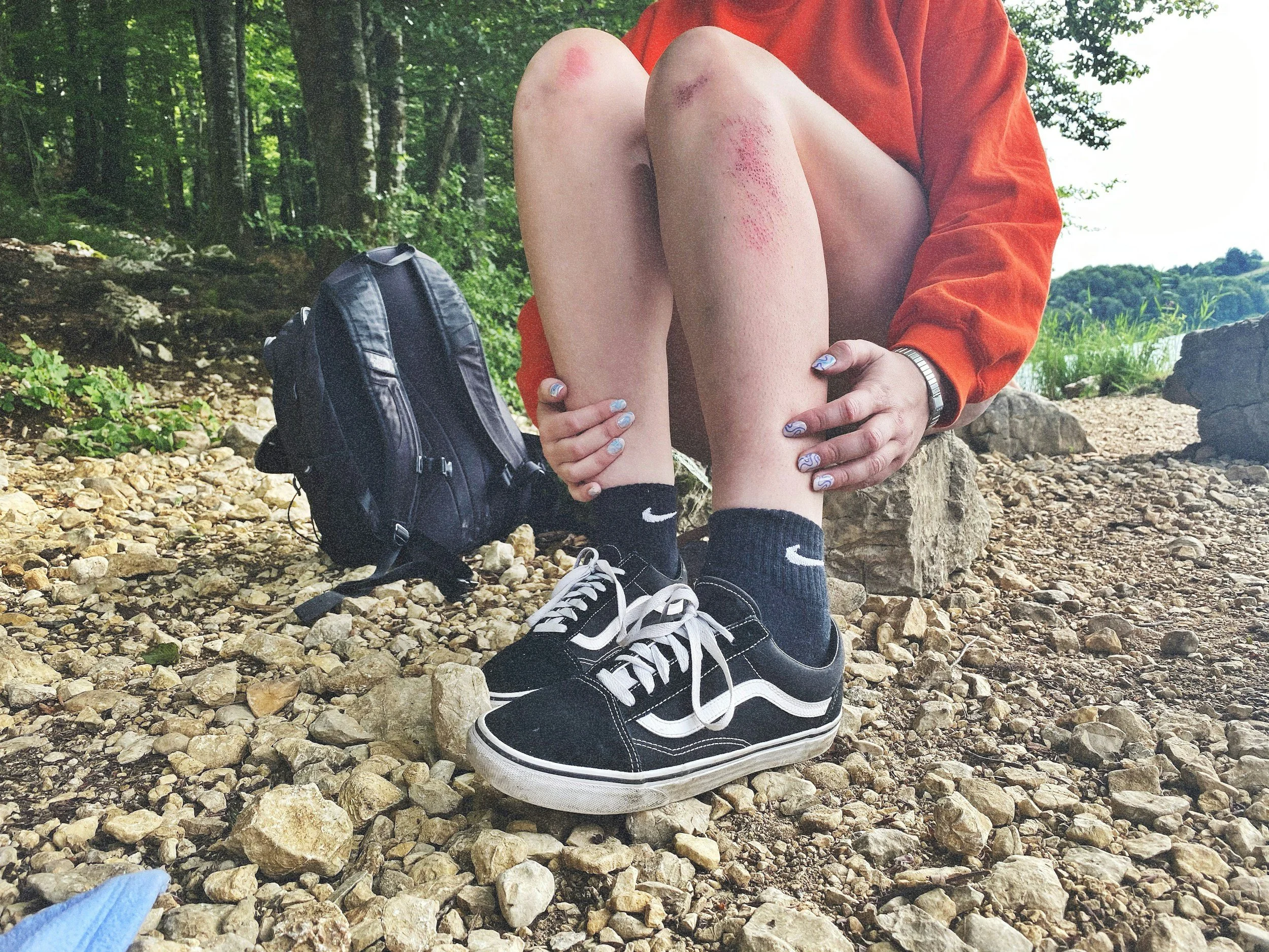 A person sitting on rocky ground in a green wooded area, wearing black and white sneakers, black socks, a red long-sleeve shirt, and holding their knees with visible bruises and abrasions on their legs.