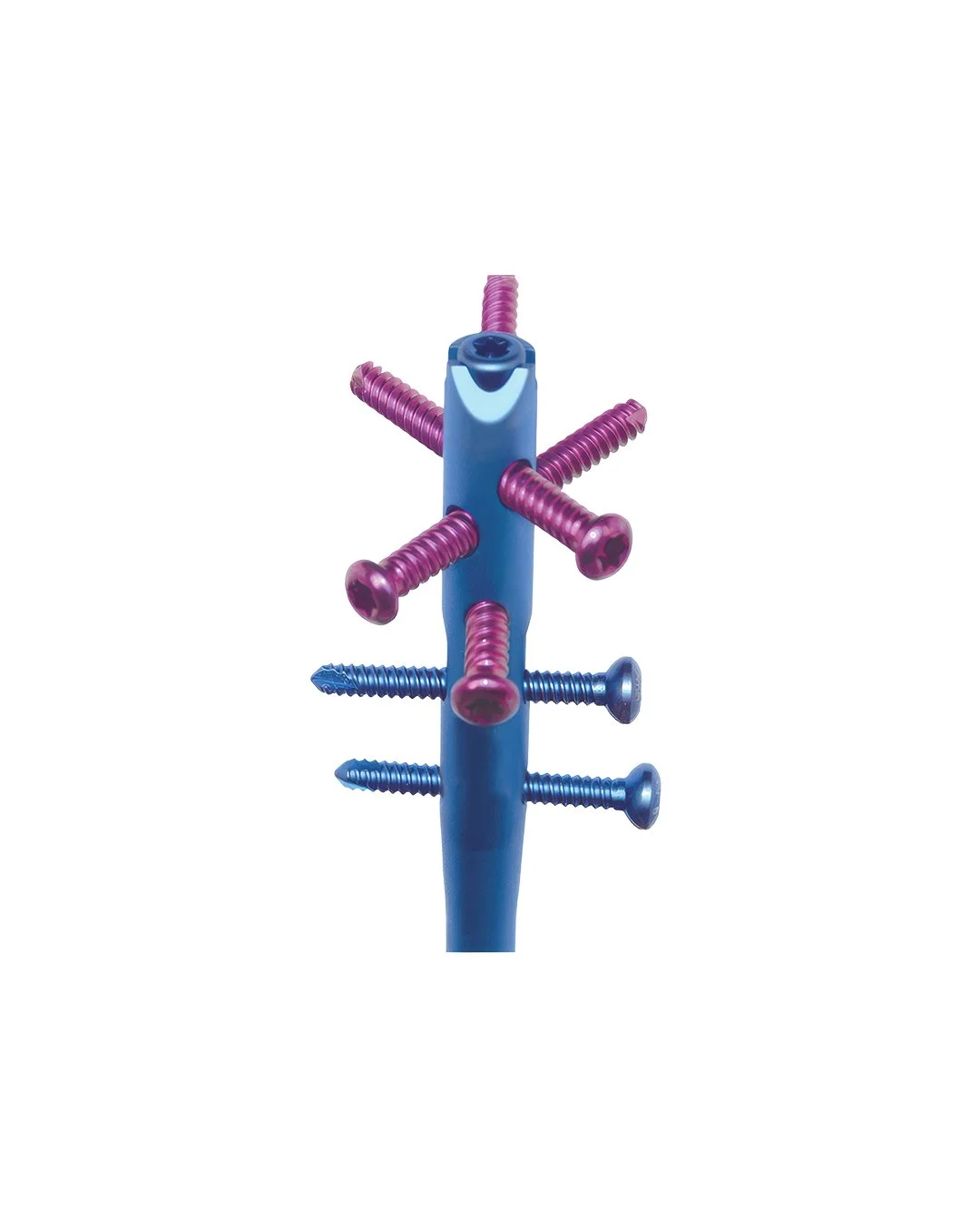 Clavo-Tibial-Universal-II-(UTN-II)-Expert5.jpg