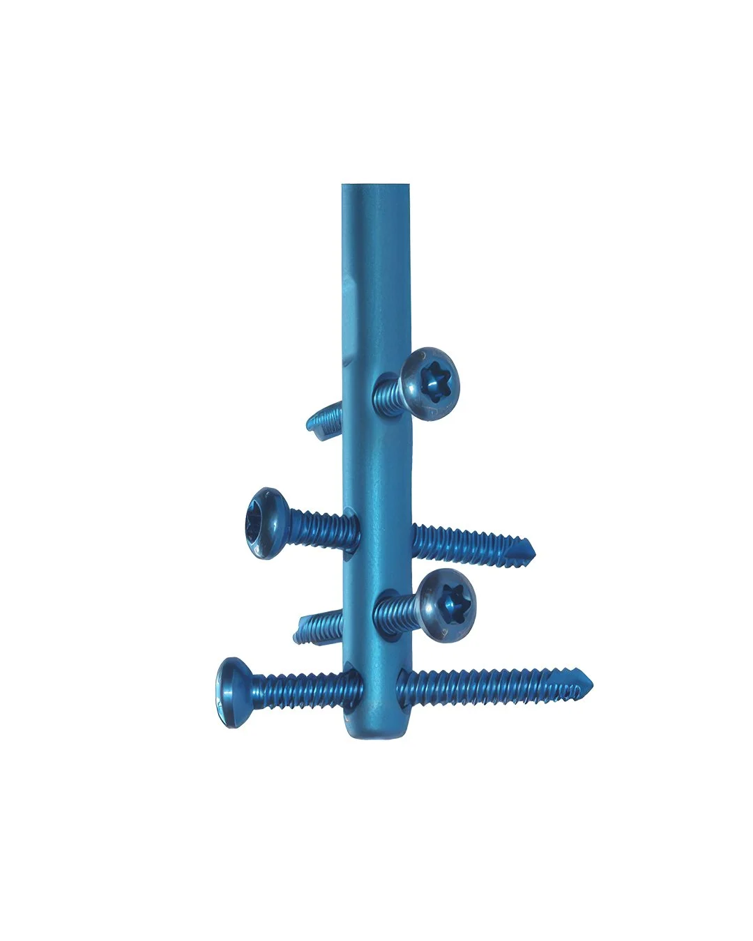 Clavo-Tibial-Universal-II-(UTN-II)-Expert3.jpg