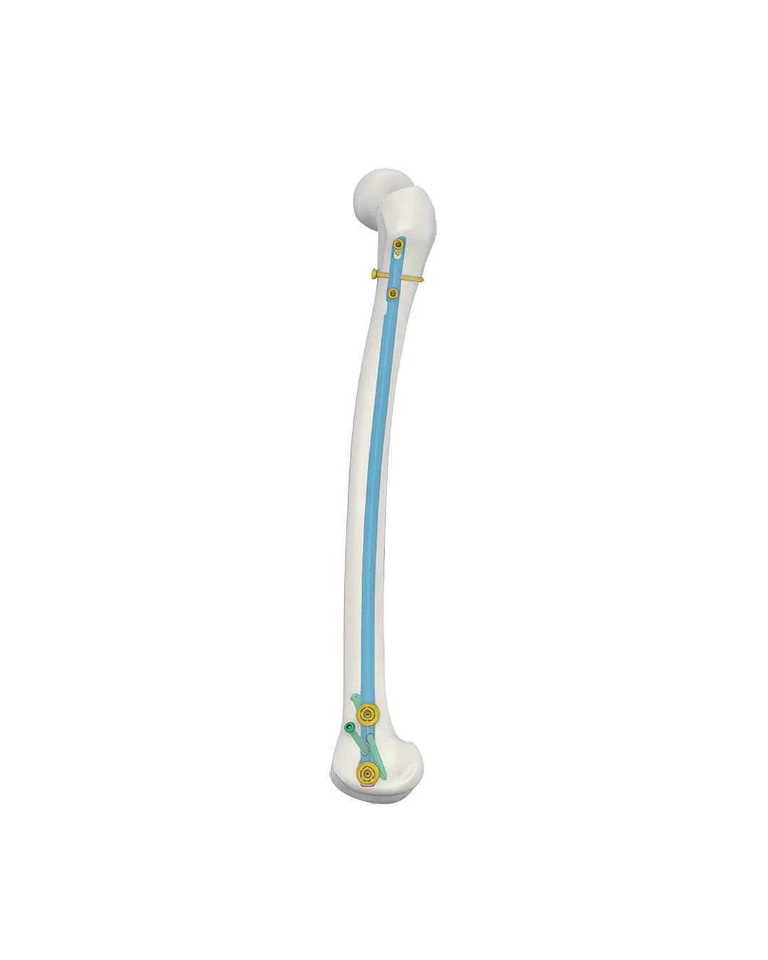 Clavo-Femoral-Retrógrado2.jpg