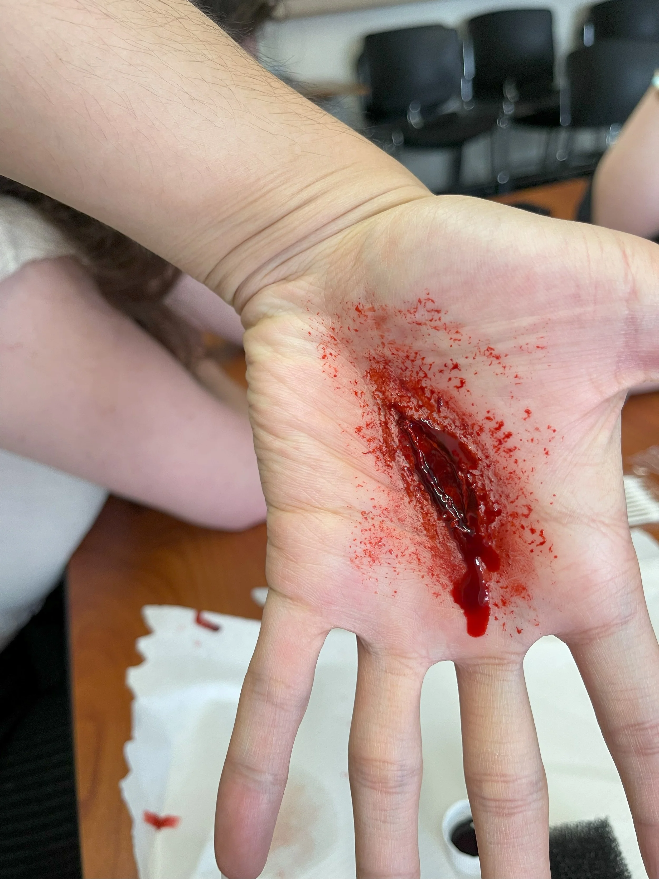 A hand with a bite mark and blood on the palm, with blood dripping from the wound.