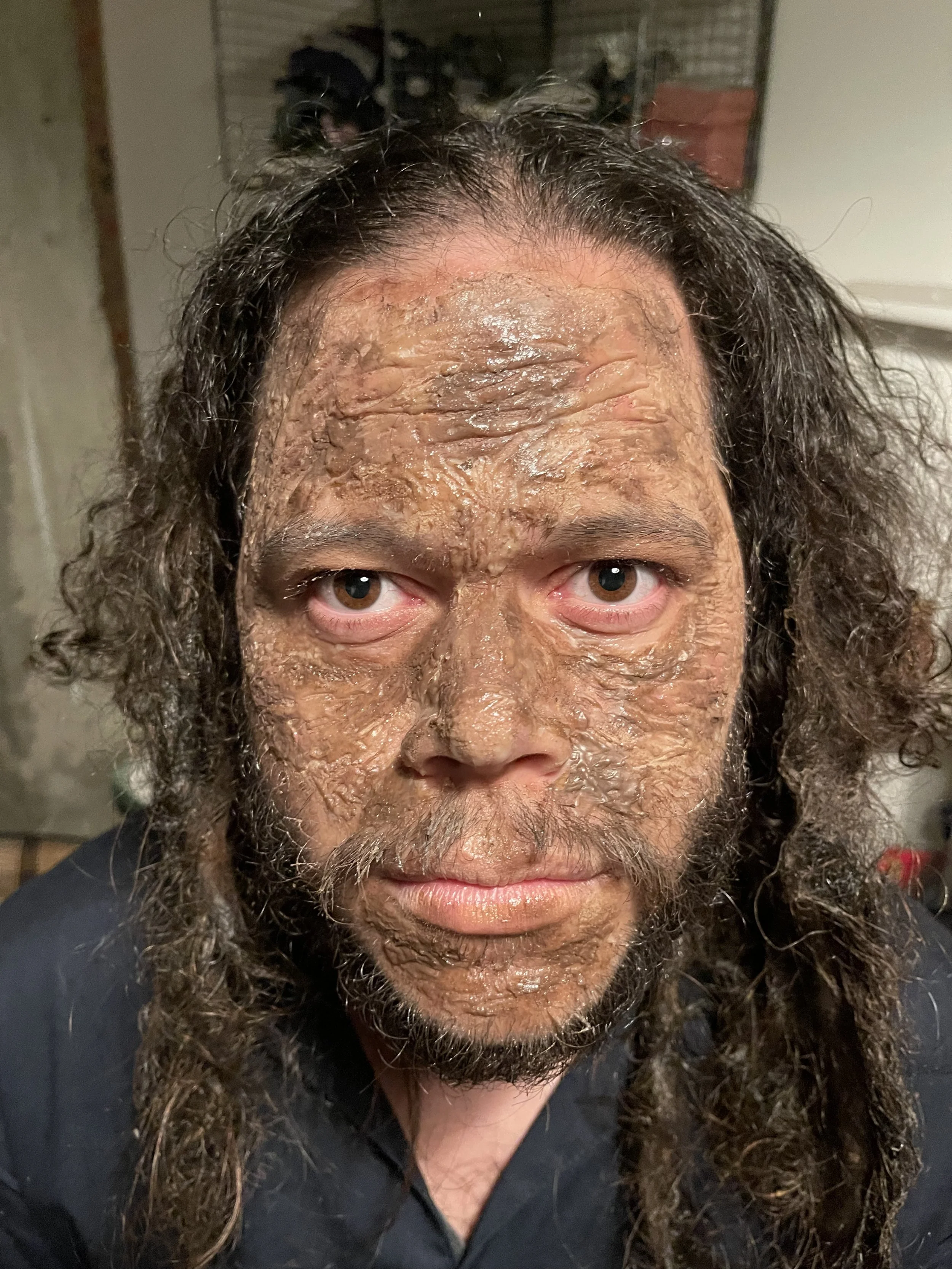 Close-up of a person with long, curly hair and a peeled or treated face, looking directly at the camera. The background shows some household items.