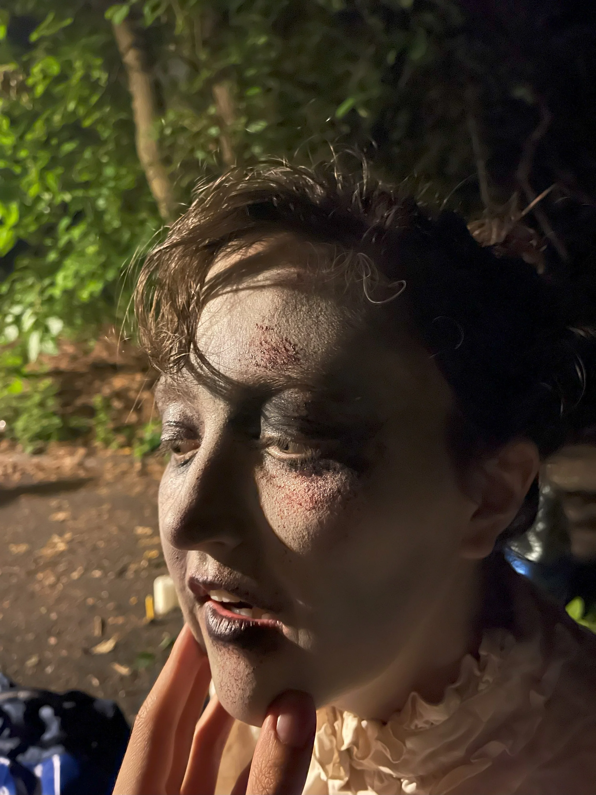 Close-up of a person's face with a red, swollen bump and scratches on the forehead, with dark curly hair and a ruffled white collar, outdoors at night with greenery in the background.