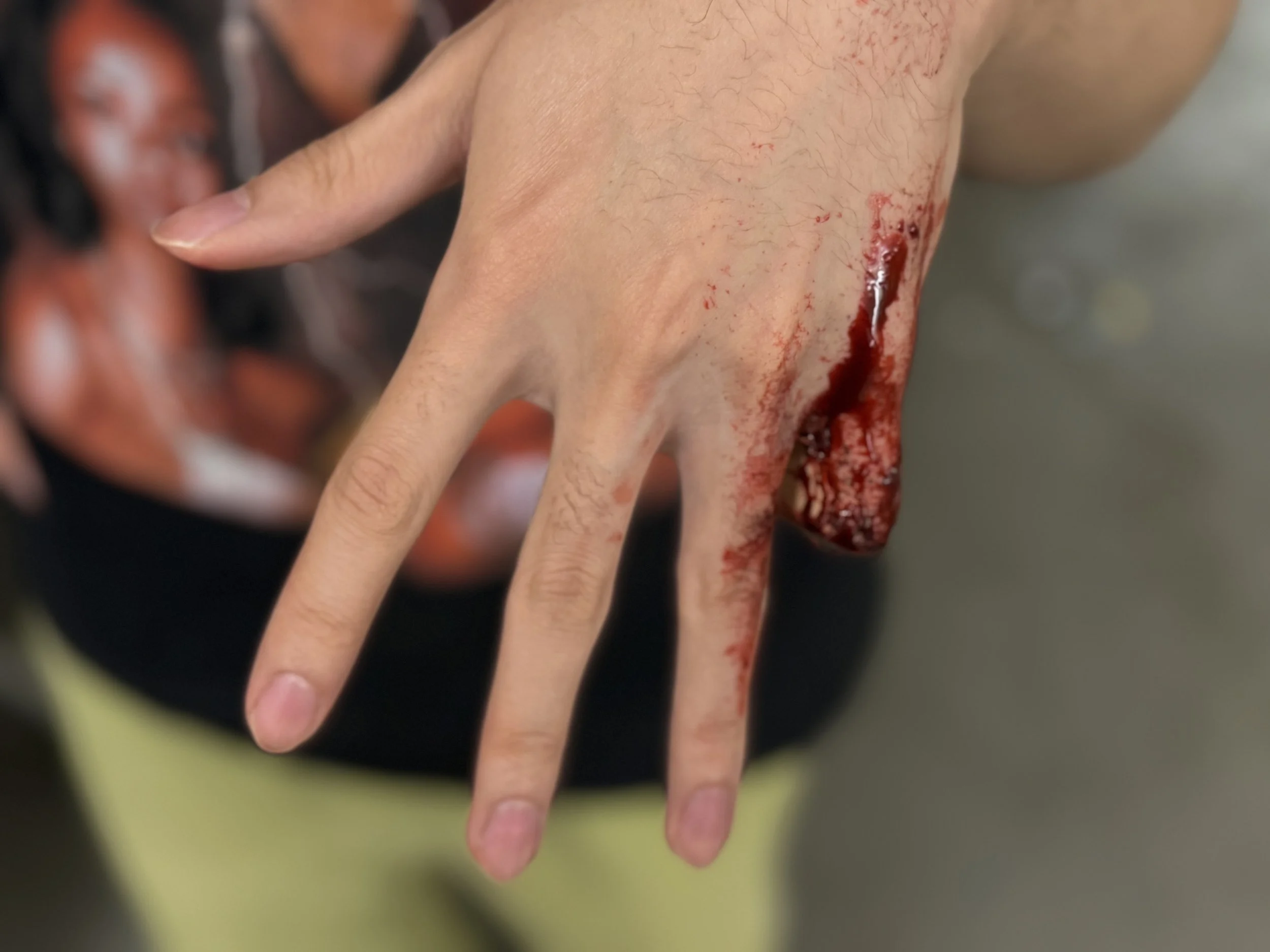 Close-up of a person's hand with a bleeding wound on the back of their hand.