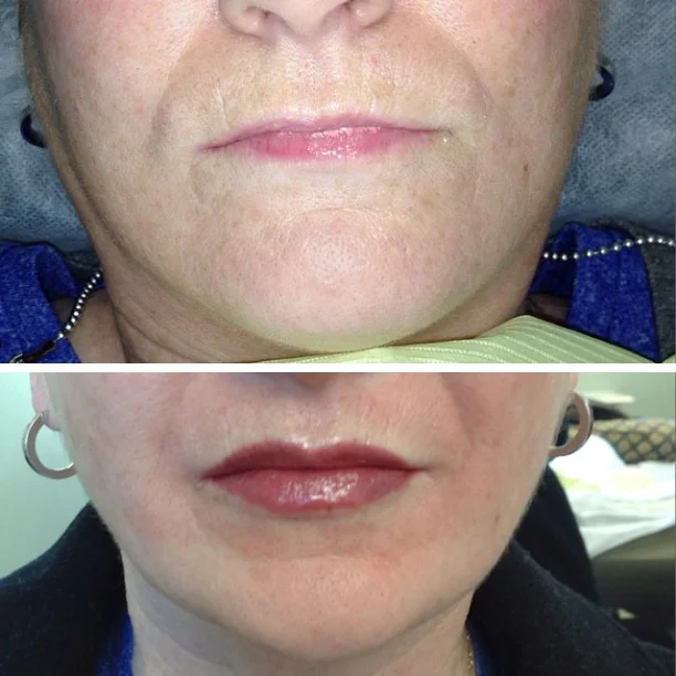 Cosmetic lip tattoo before-and-after comparison by Brianna Errelat