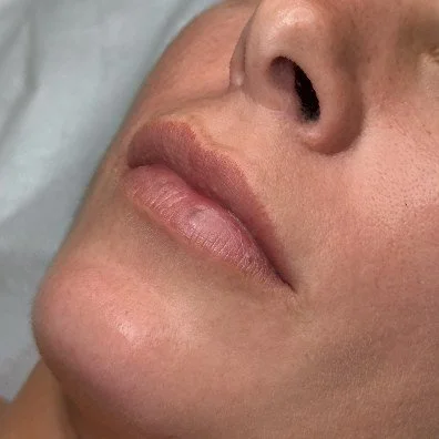 Lips before lip blush treatment by Brianna Errelat