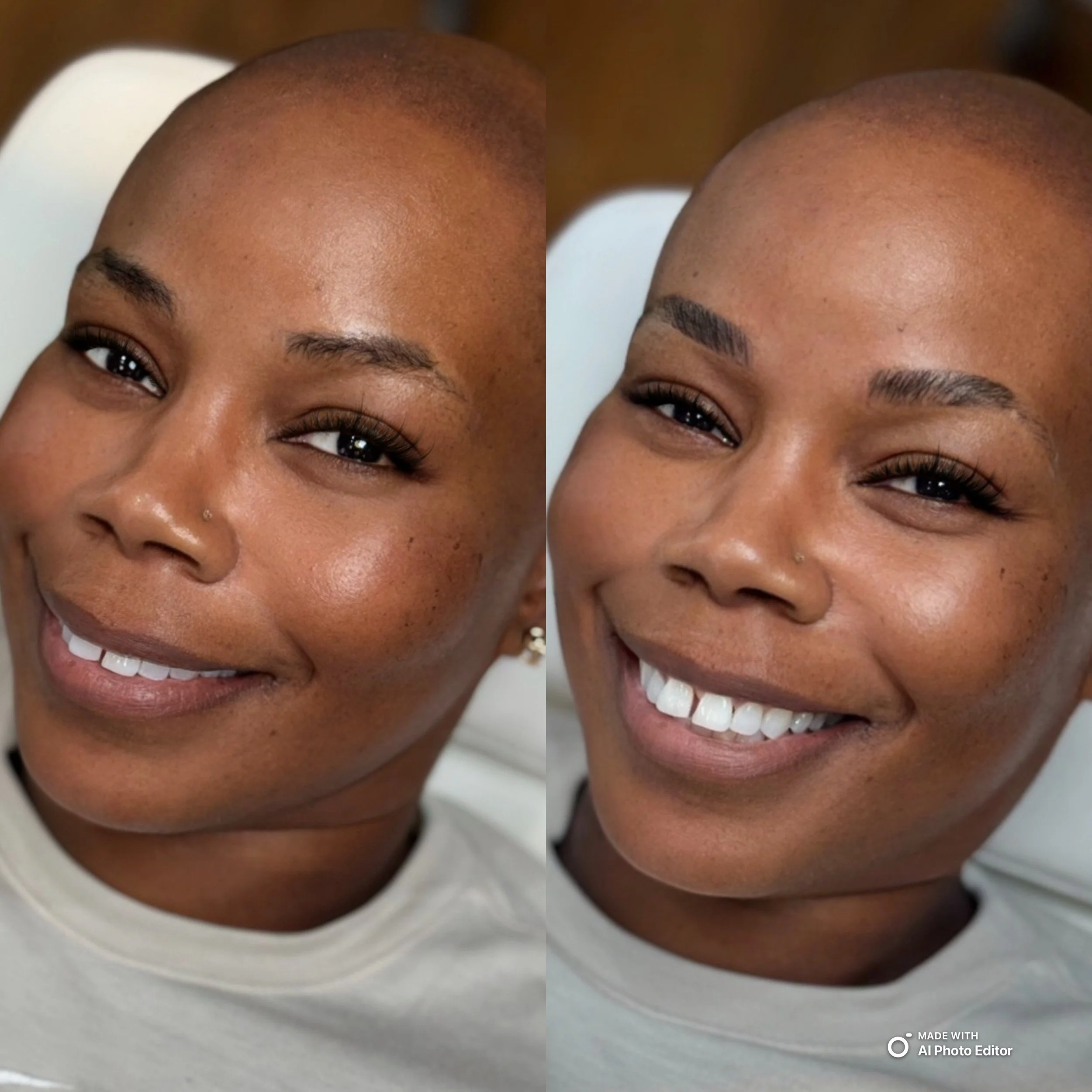 Close-up of a smiling woman with a shaved head, wearing makeup, small nose piercing, and earrings, sitting in a medical chair.