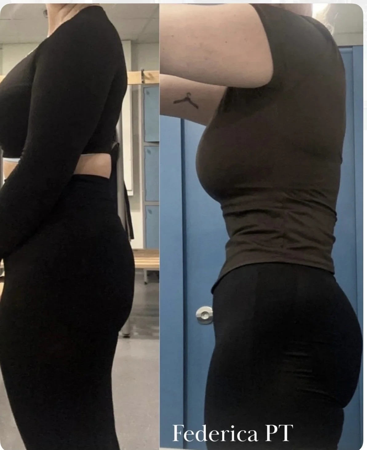 A side-by-side comparison of a woman's torso before and after physical therapy. On the left, she is wearing a black crop top and high-waisted leggings, standing in what appears to be a gym or therapy room. On the right, she is wearing a gray fitted t-shirt and black leggings, with visible muscle changes. The photo is credited to Federica PT.