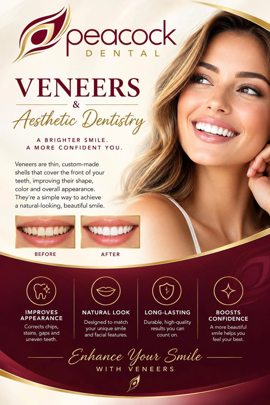 An advertisement for Peacock Dental featuring a smiling woman with white teeth, promoting dental veneers and aesthetic dentistry. It includes before and after images of teeth, and icons highlighting benefits like improved appearance, natural look, long-lasting results, and boosted confidence.