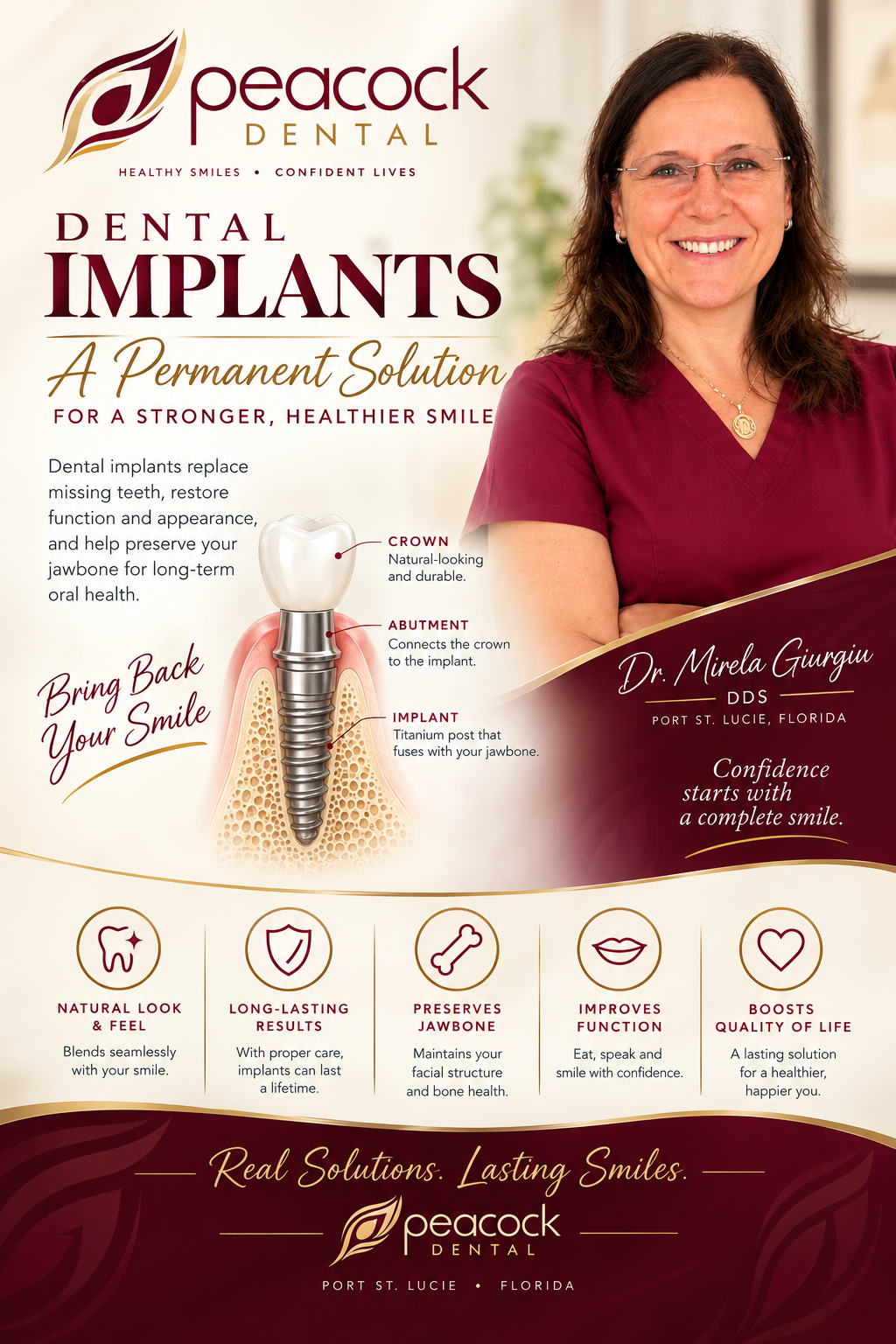 Advertisement for Peacock Dental offering dental implants, featuring a smiling female dentist in burgundy scrubs, an illustration of a dental implant, and text highlighting benefits such as natural look, long-lasting results, jawbone preservation, improved function, and quality of life.