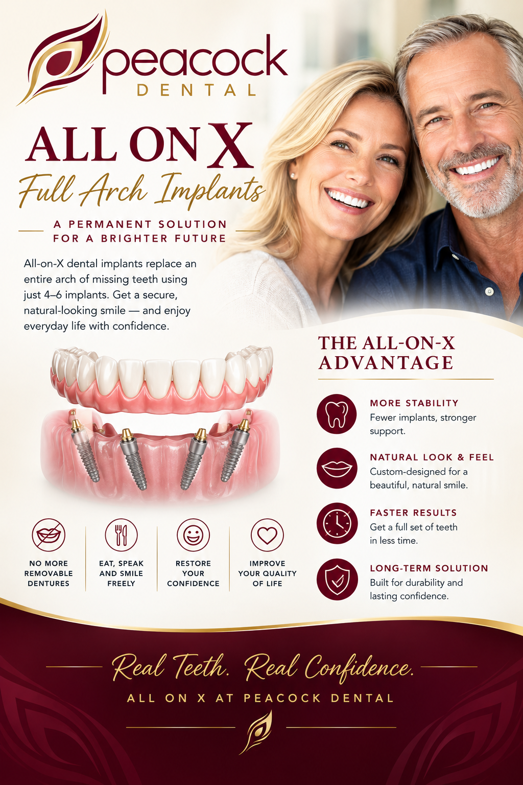 A promotional flyer for Peacock Dental's All-on-X full arch implant solution, featuring a smiling middle-aged couple, a diagram of dental implants replacing missing teeth, and icons highlighting benefits like no removable dentures, eating and smiling freely, restoring confidence, and improving quality of life.