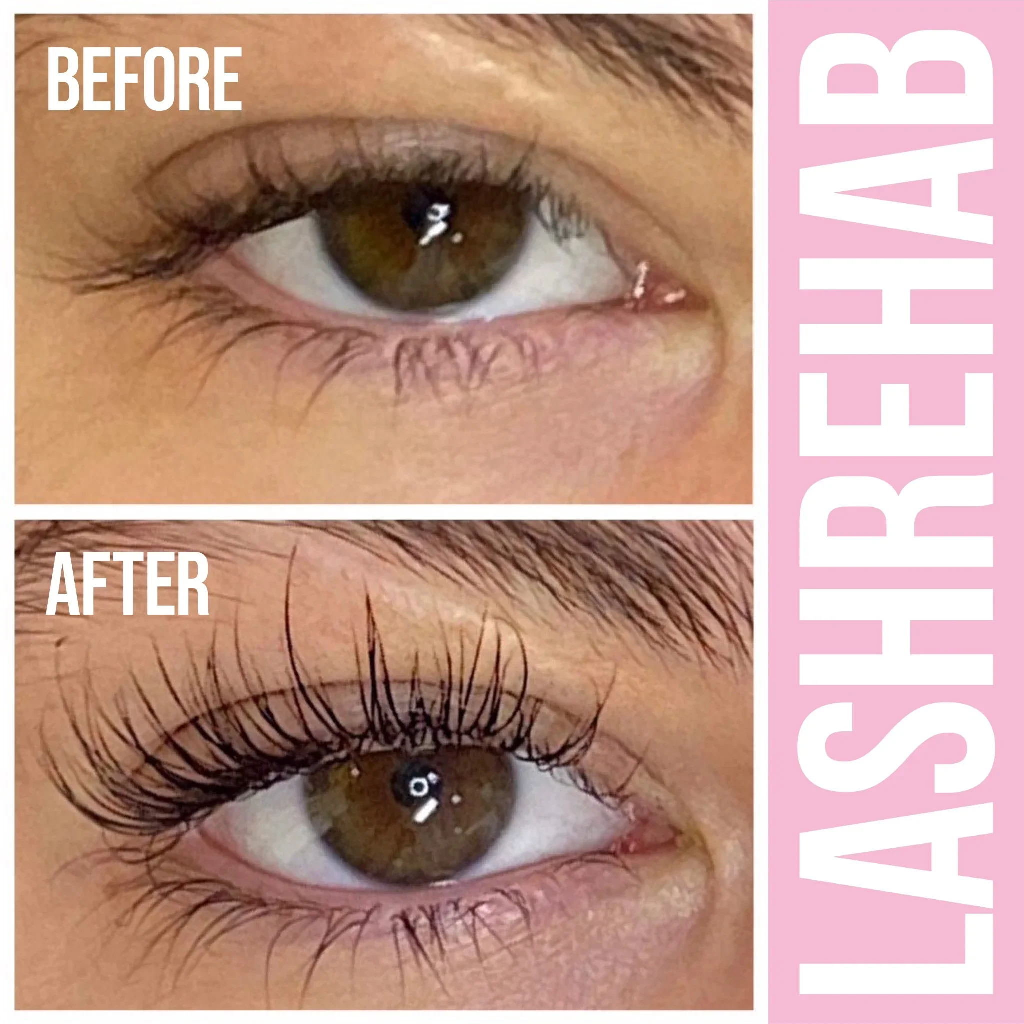 LR-Before-After-04_1.webp