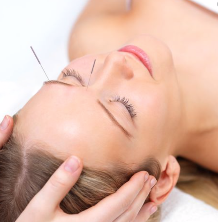 ACUPUNCTURE