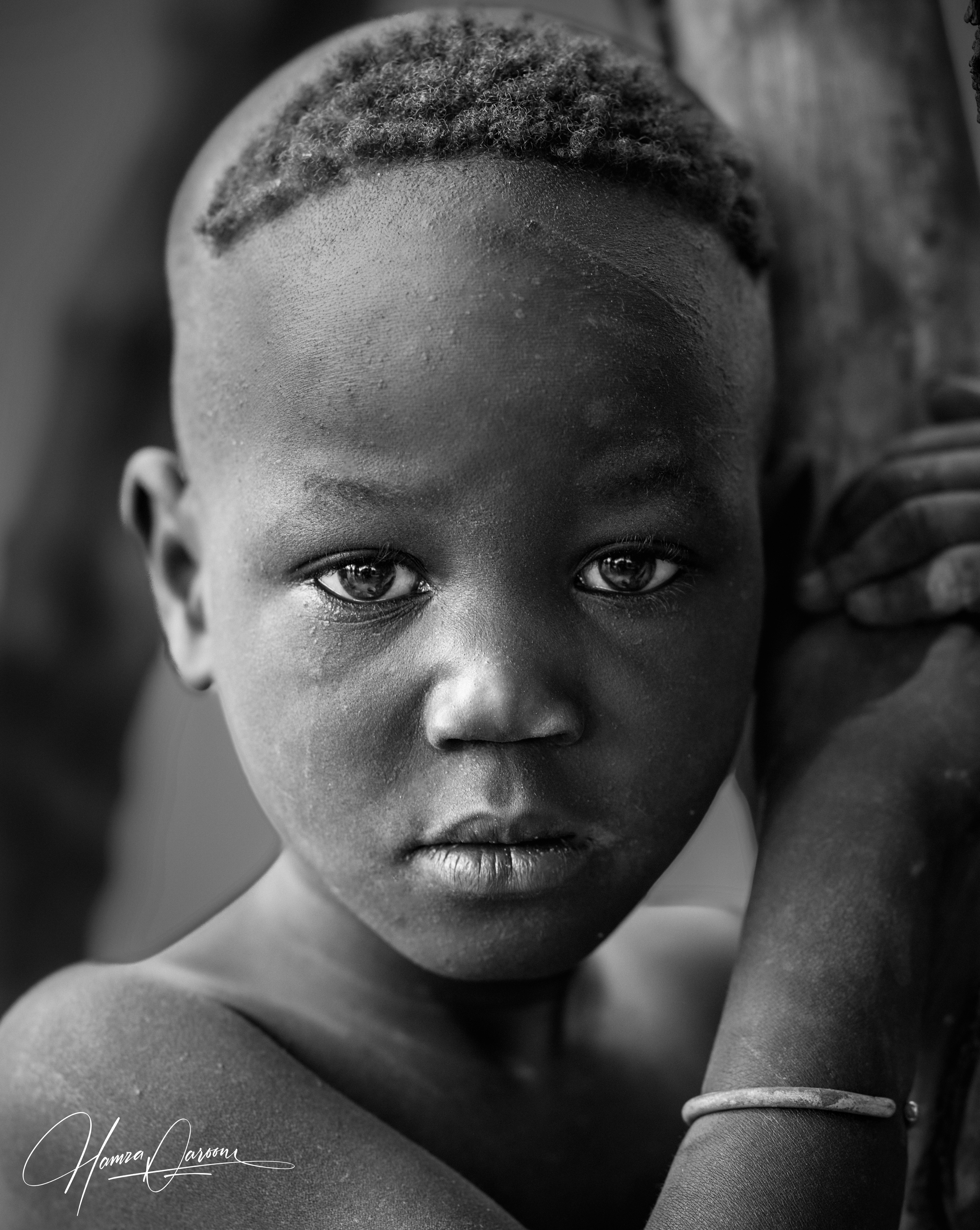 Close-up black-and-white photo of a young child with short curly hair, large expressive eyes, and a serious expression, resting their head on their hand, wearing a bracelet.