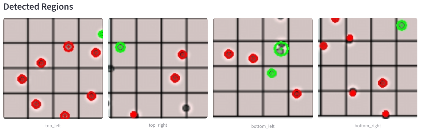AI Powered Hemocytometer App