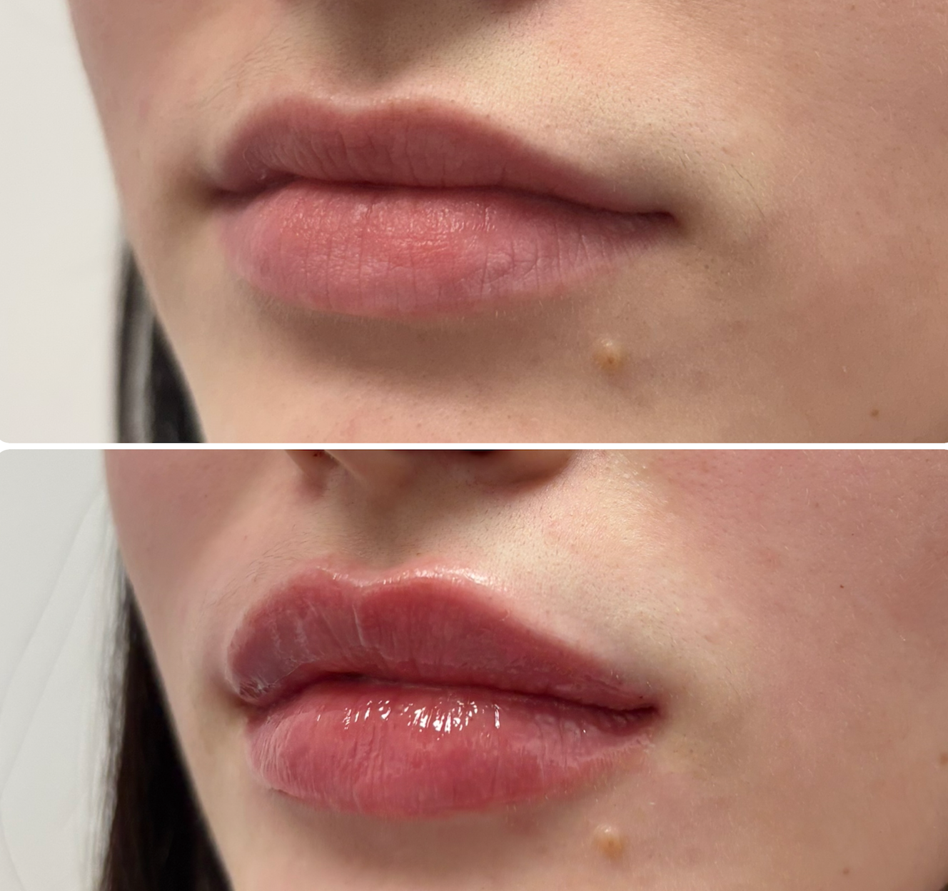 Close-up of a person's lips and facial skin, showing a before and after comparison of lip gloss application.