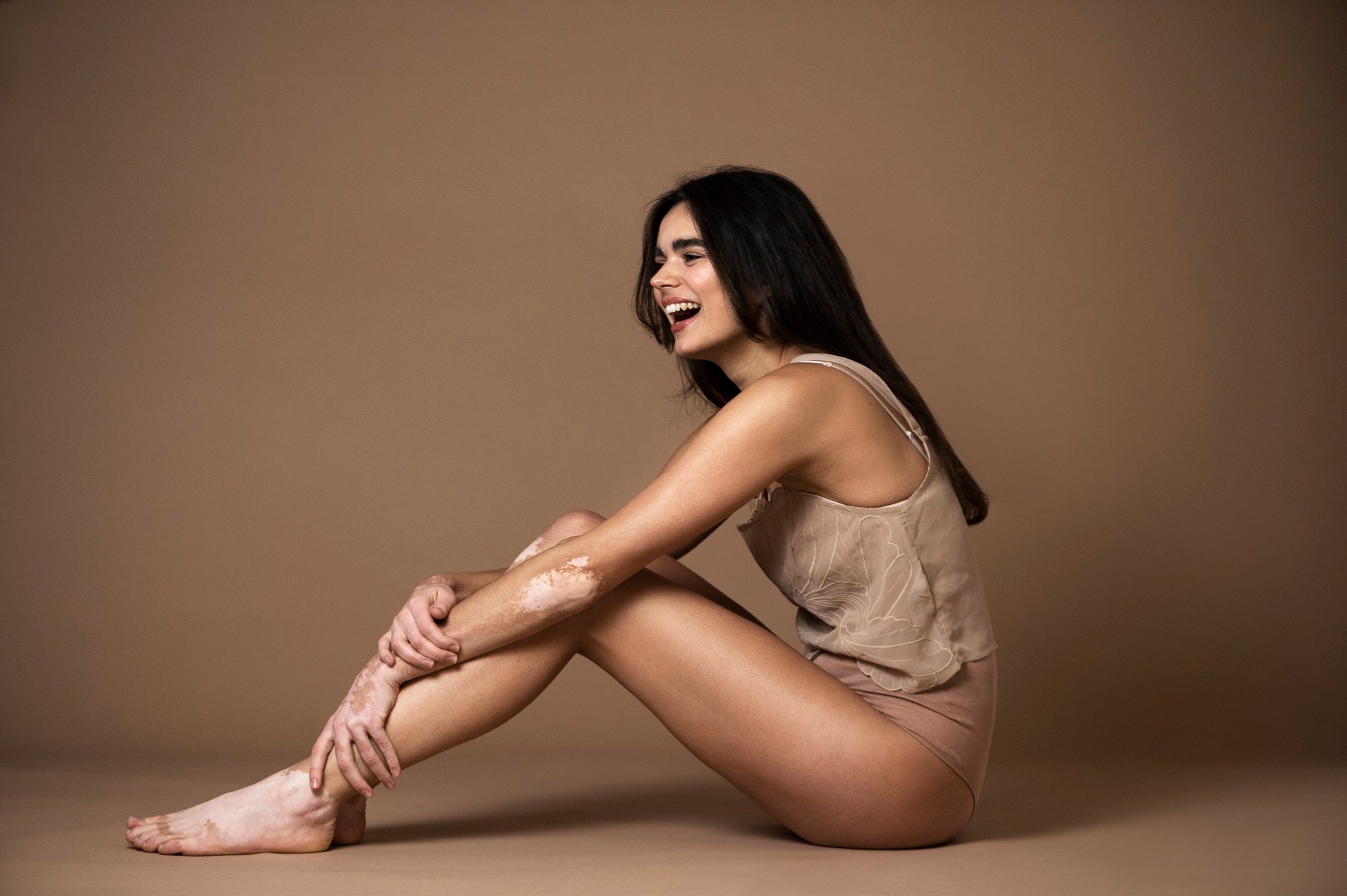 Lachende Frau mit Vitiligo sitzt barfuß in einem beigen Outfit vor braunem Hintergrund.