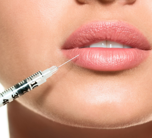 Close-up of a woman’s lips with a syringe near her lips, suggesting a lip injection or cosmetic procedure.