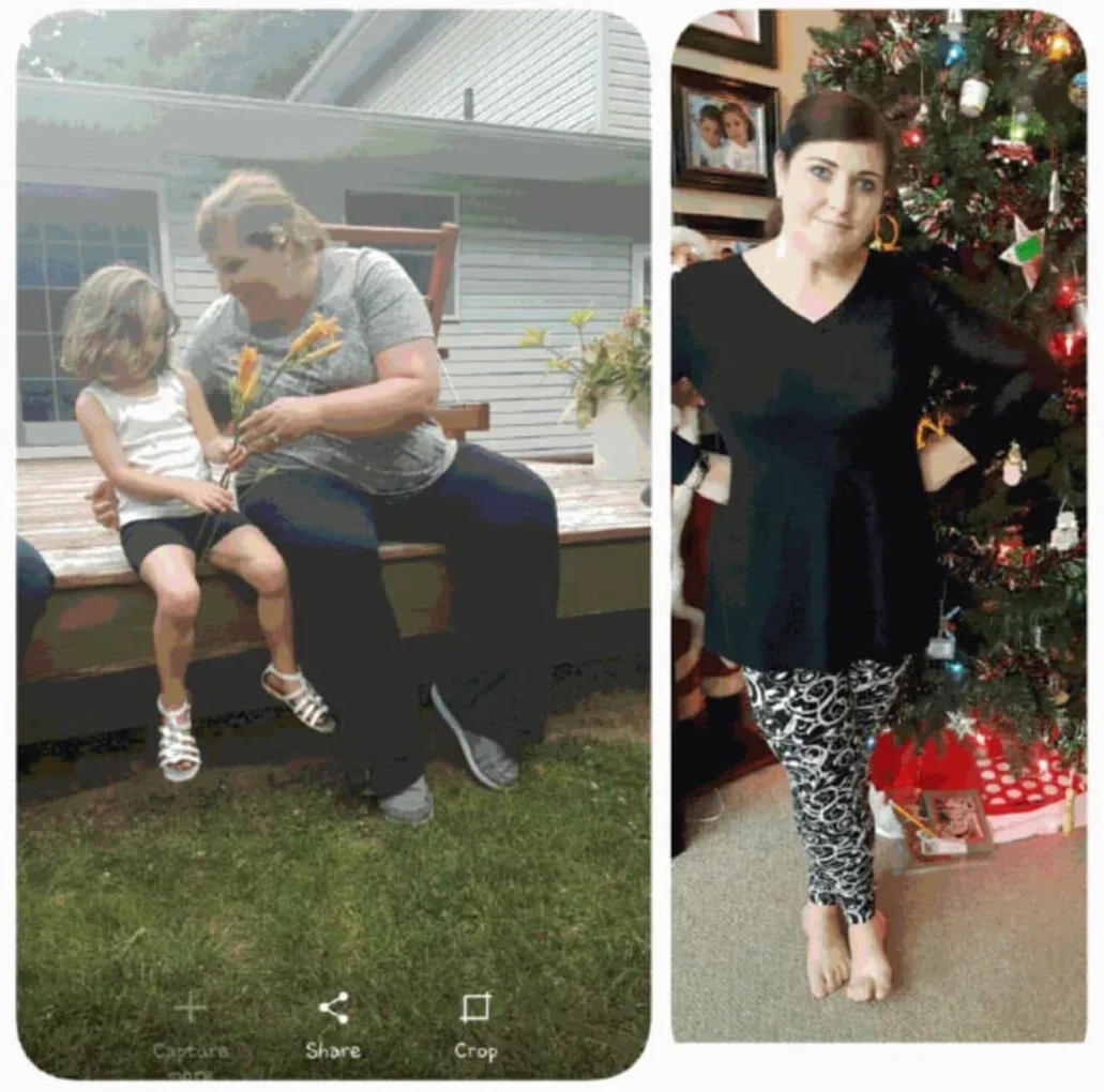 Chad Roth before and after, located in Crown Point, Indiana
