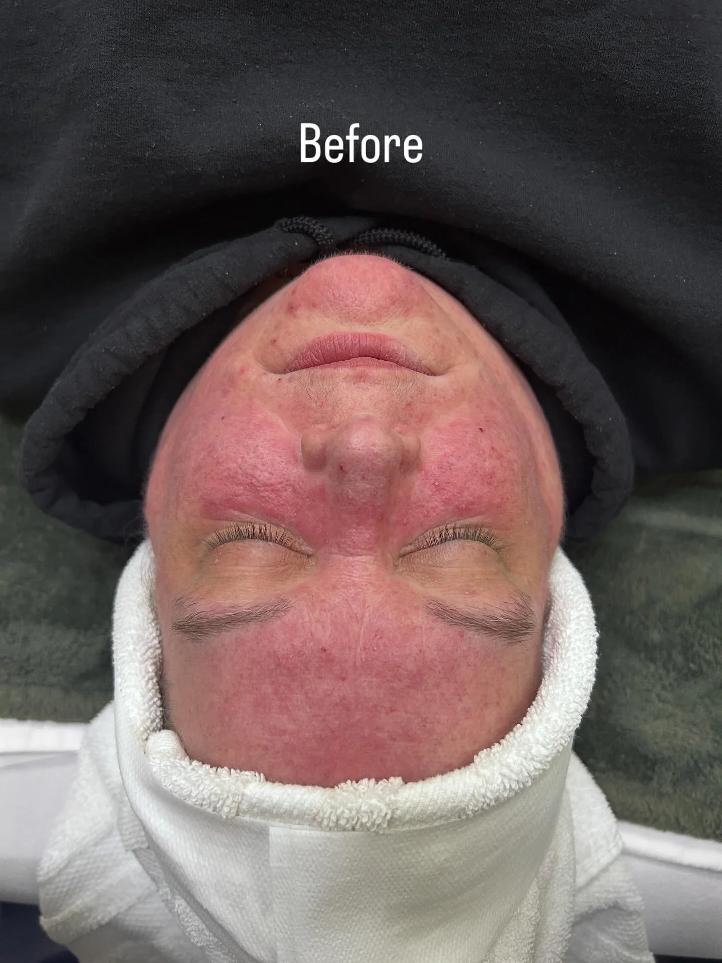 esthetician spa facial vancouver wa washington 98660