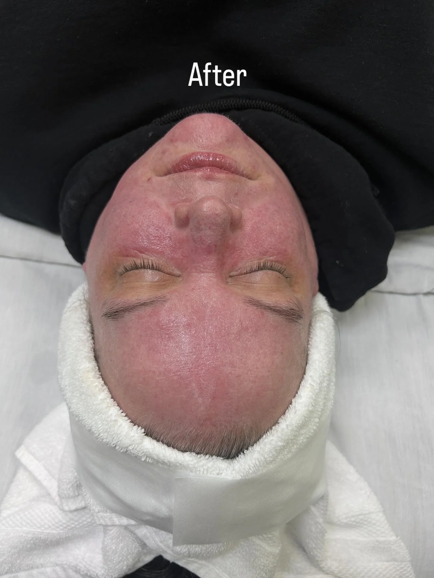 spa facial esthetician vancouver wa washington 98660
