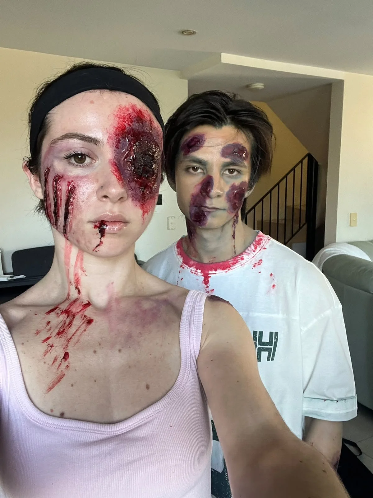 Two people posing indoors with realistic Halloween zombie makeup, fake blood, bruises, and facial wounds.
