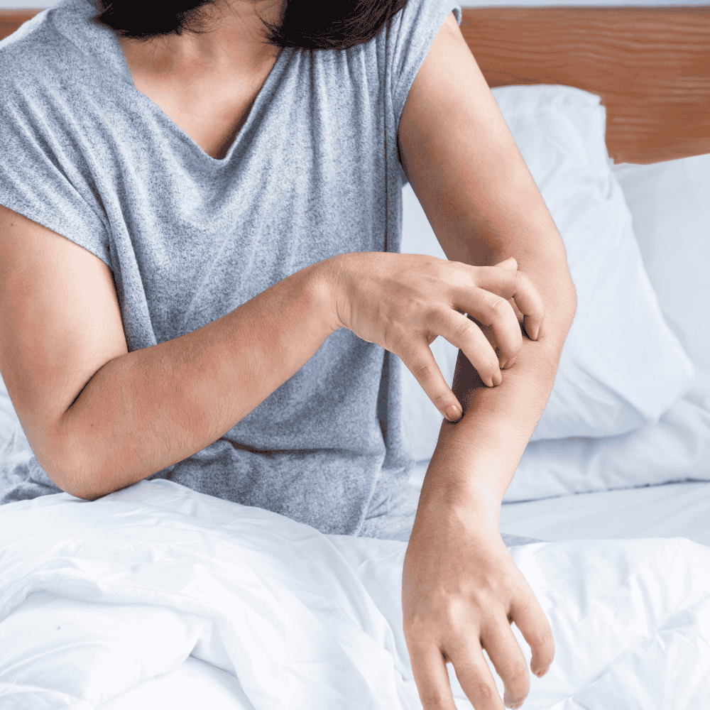The Bed Bug Comeback: Why Infestations Have Risen in Modern Times