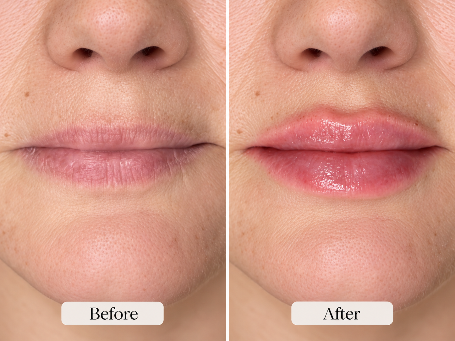 Close-up of a person's lips and nose showing a before-and-after comparison, with the lips appearing more moisturized and shiny in the after photo.