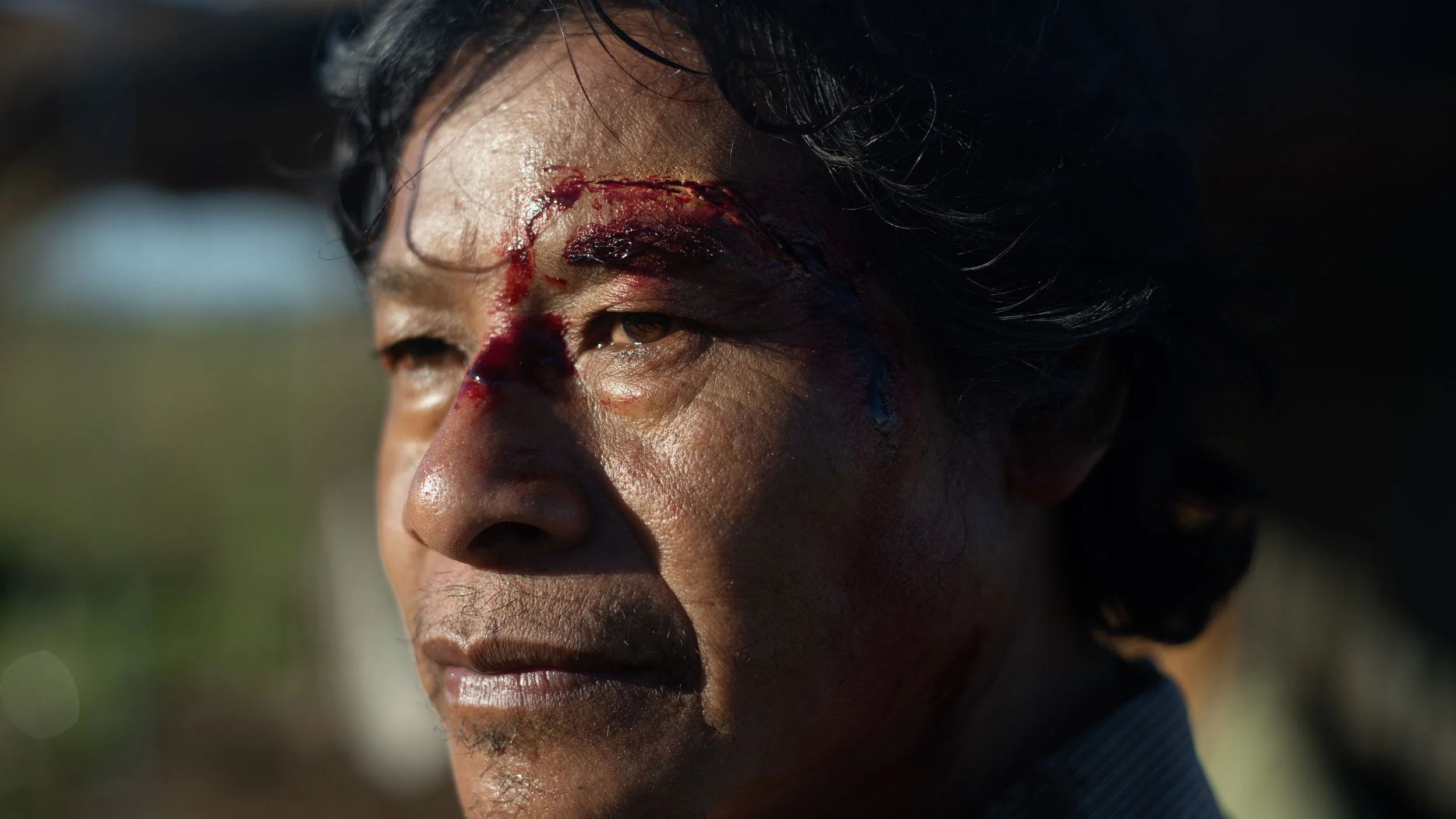 Close-up of a person's face showing a fresh head wound with blood above the eyebrow.