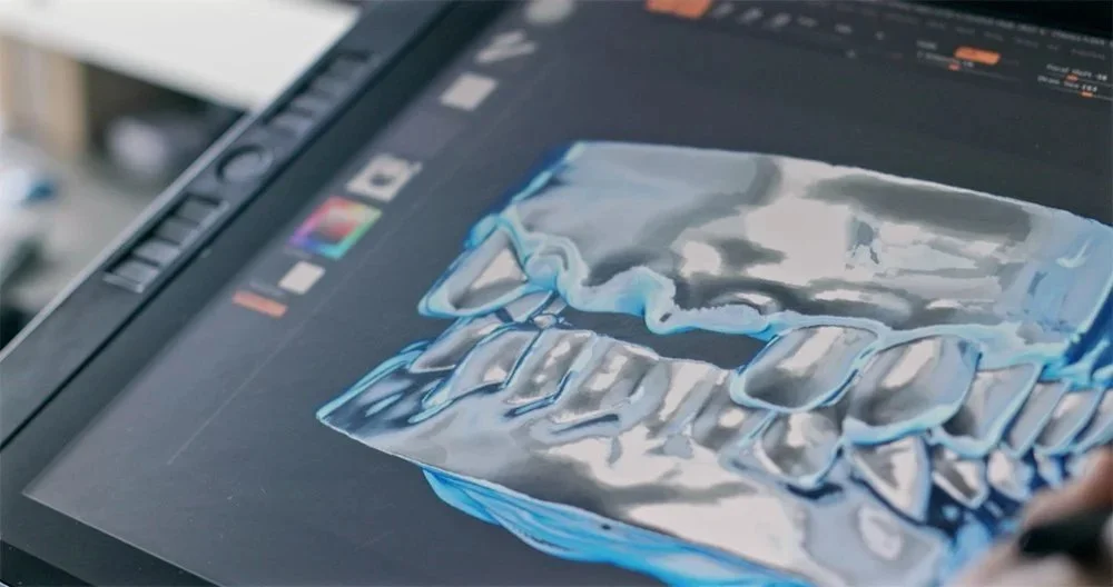 3D scan of the denture on a tablet