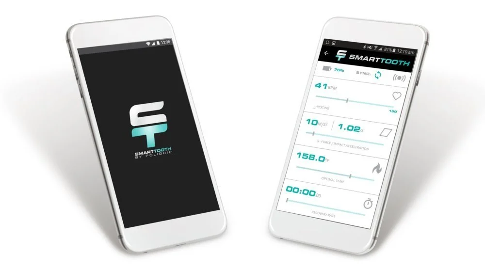 The SmartTooth app on two phones