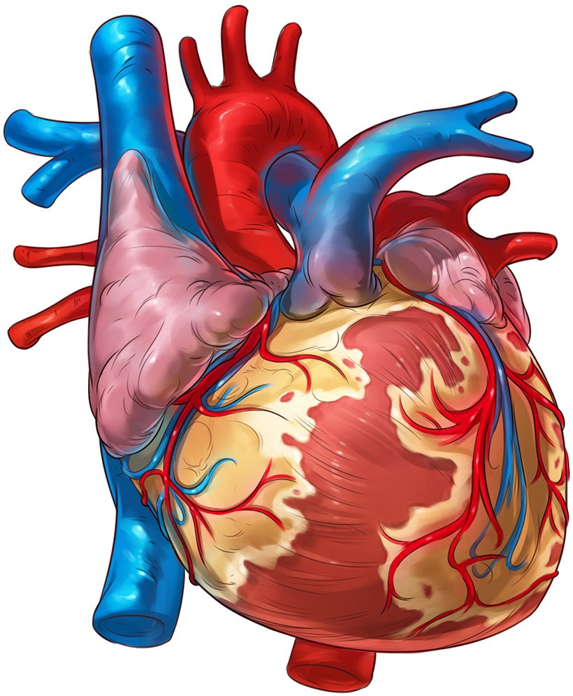 6_2_P_OpenHeart_Final_fix2.jpg