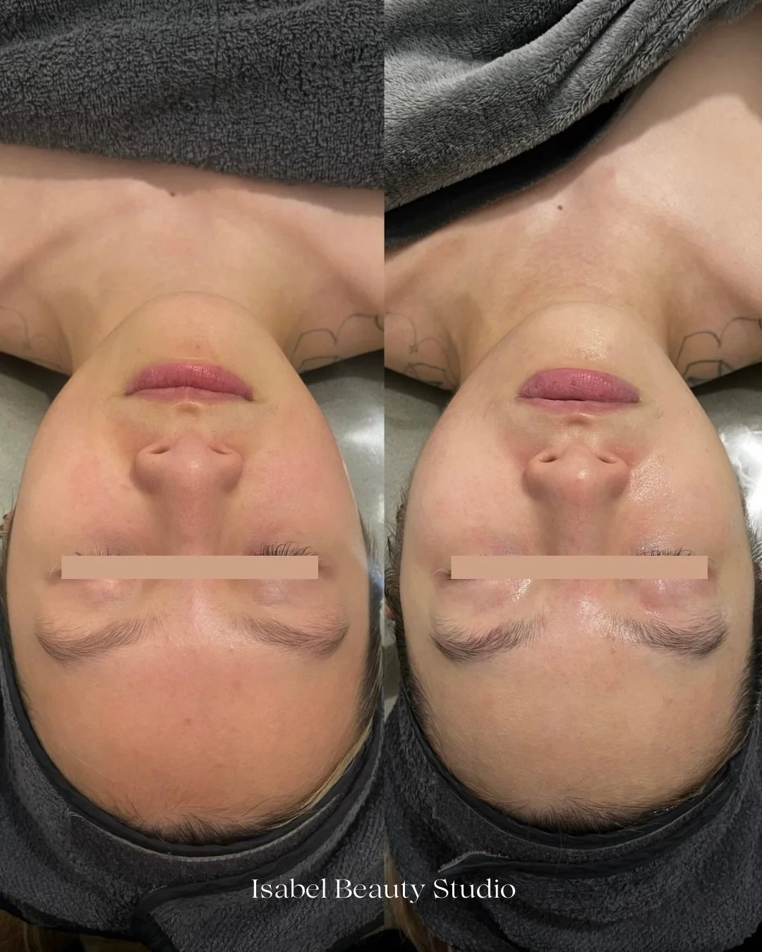 Before-and-after facial treatment comparison showing a woman's smoother, more even forehead and skin complexion at Isabel Beauty Studio.