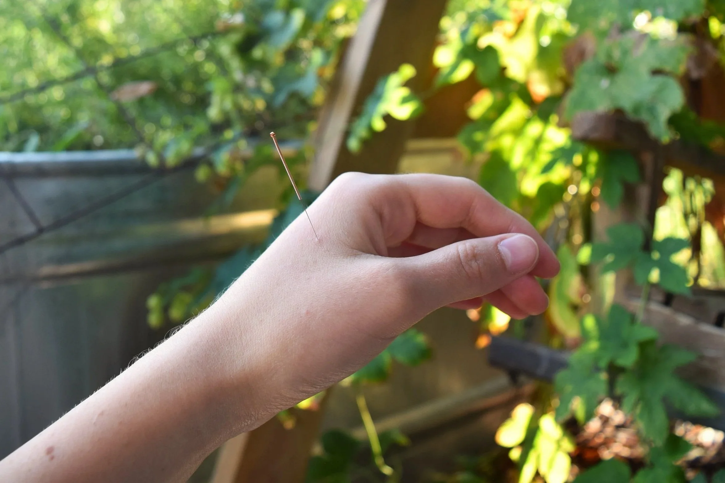 A person with an acupuncture needle in their hand.