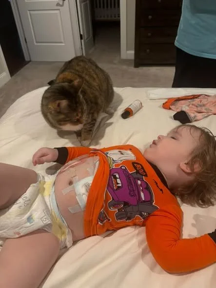 A young child lying on a bed with a colorful shirt, medical bandage on their stomach, and a diaper. A tabby cat is sitting nearby, both in a bedroom with an open door and dresser visible.