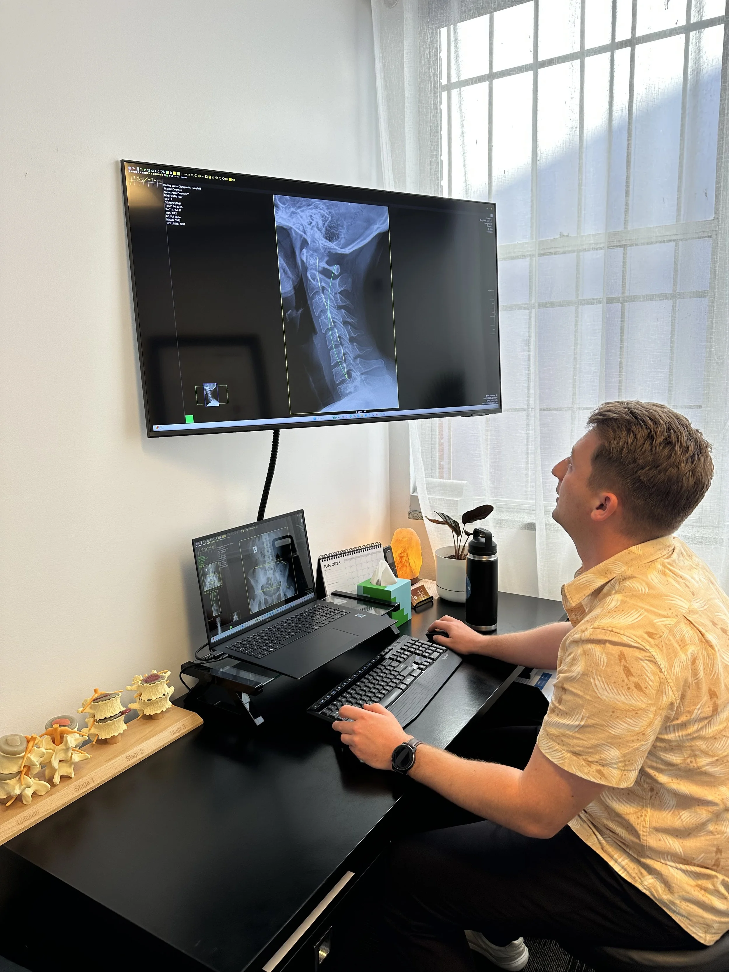 A man sitting at a desk looking at a computer monitor displaying an X-ray image of a neck and spine, with a second laptop and desk accessories nearby.