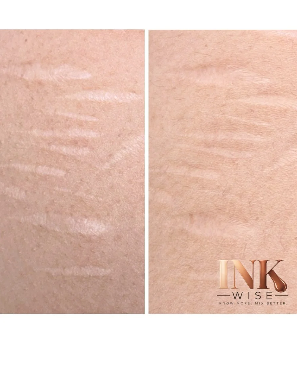 Stretch mark camouflage before and after with well-balanced organic pigments
