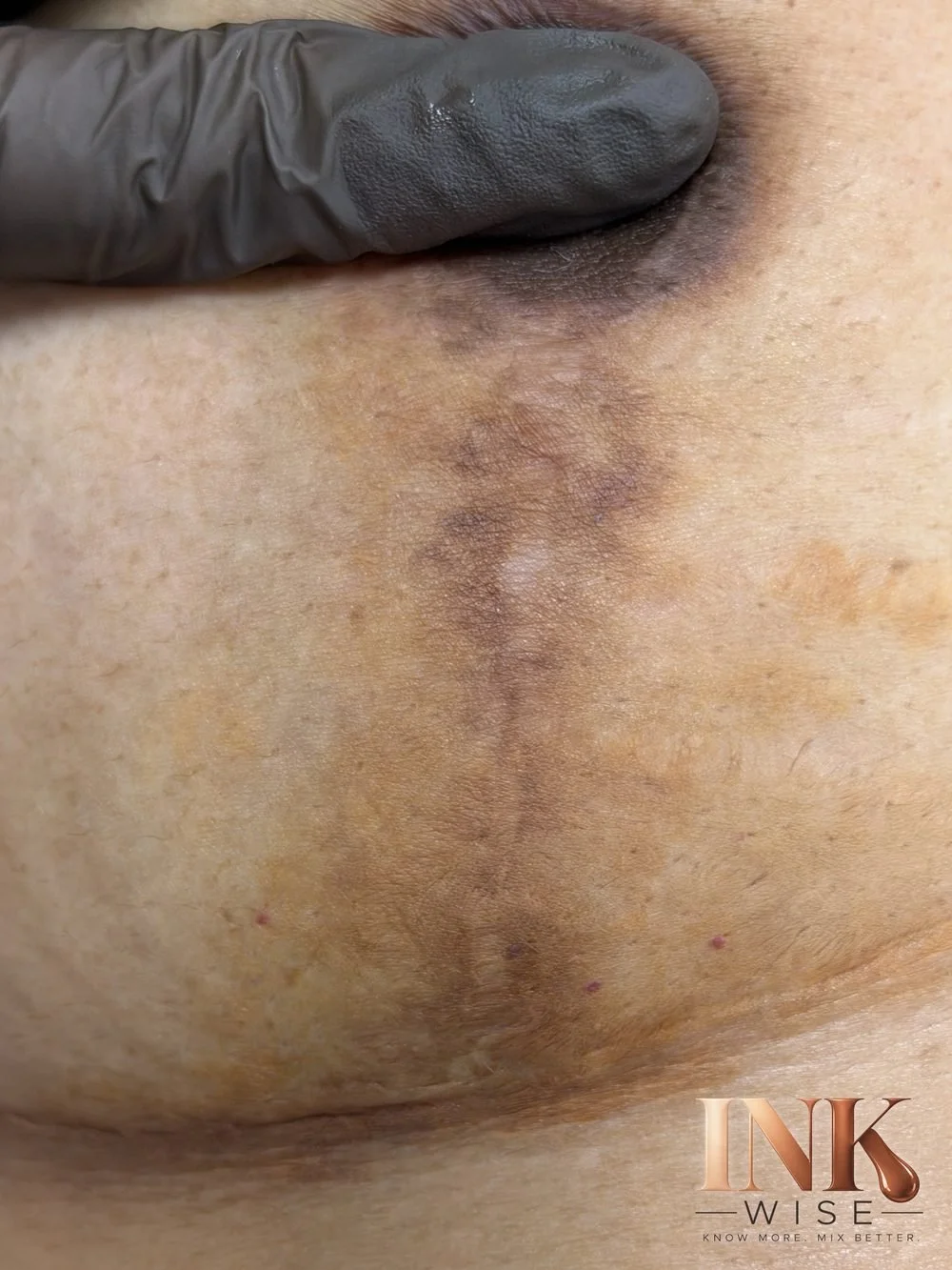 Scar camouflage with oxidized iron oxide ink turning orange and brown