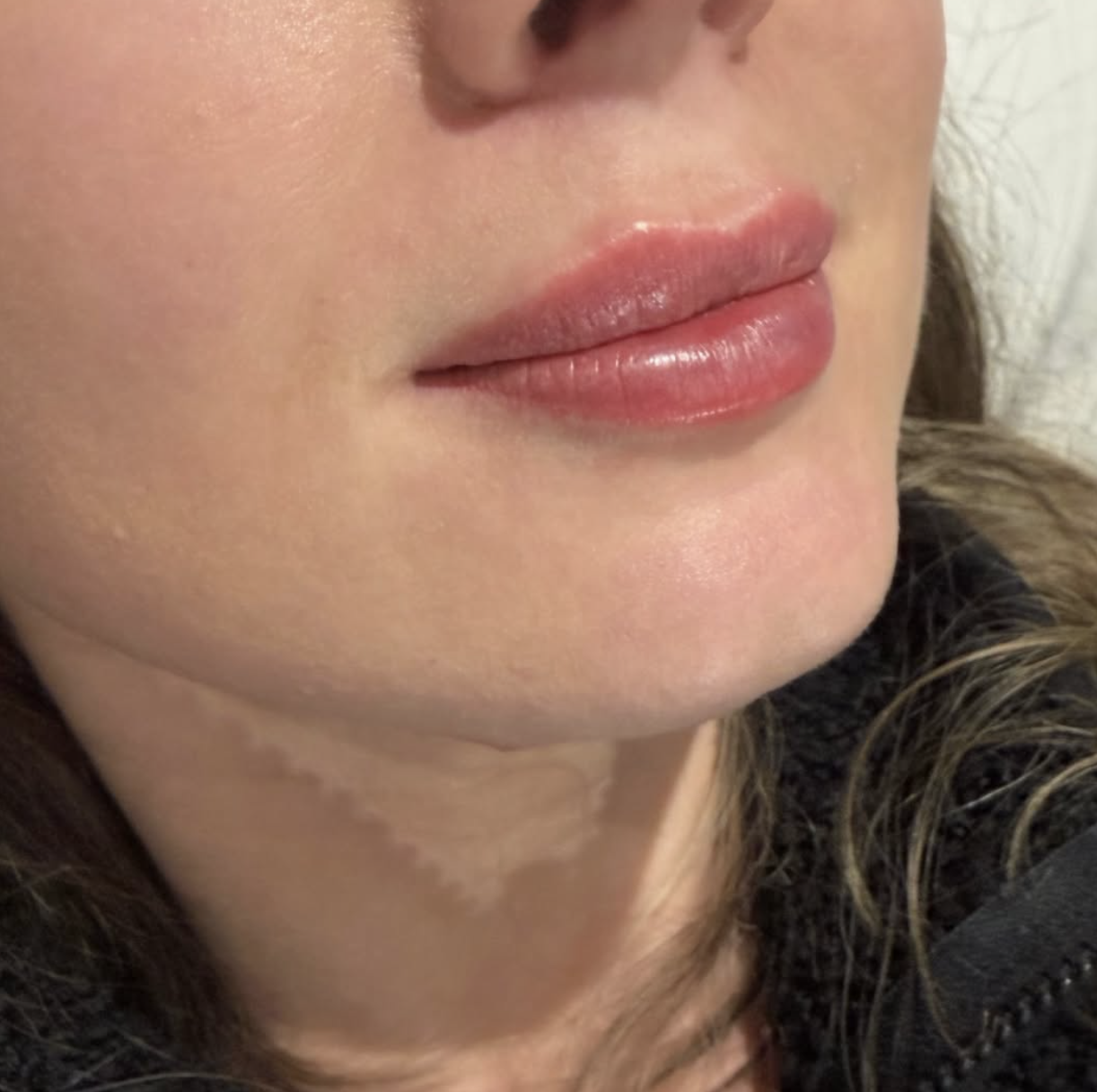 Close-up of a woman's lips with pink gloss, showing smooth skin and a small nose, part of her cheek and hair visible.