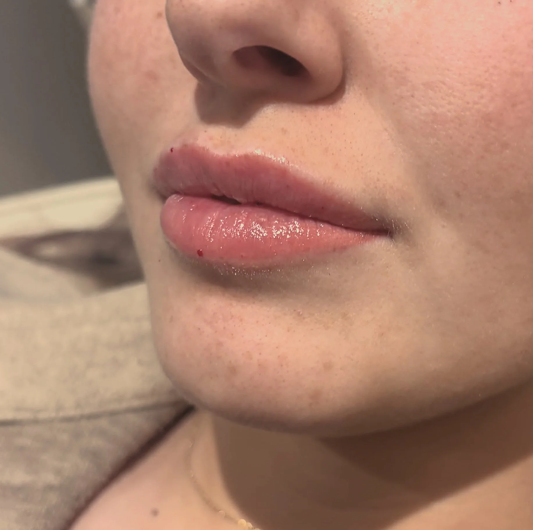 Close-up of a woman's nose and lips, with smooth skin and natural lip gloss.