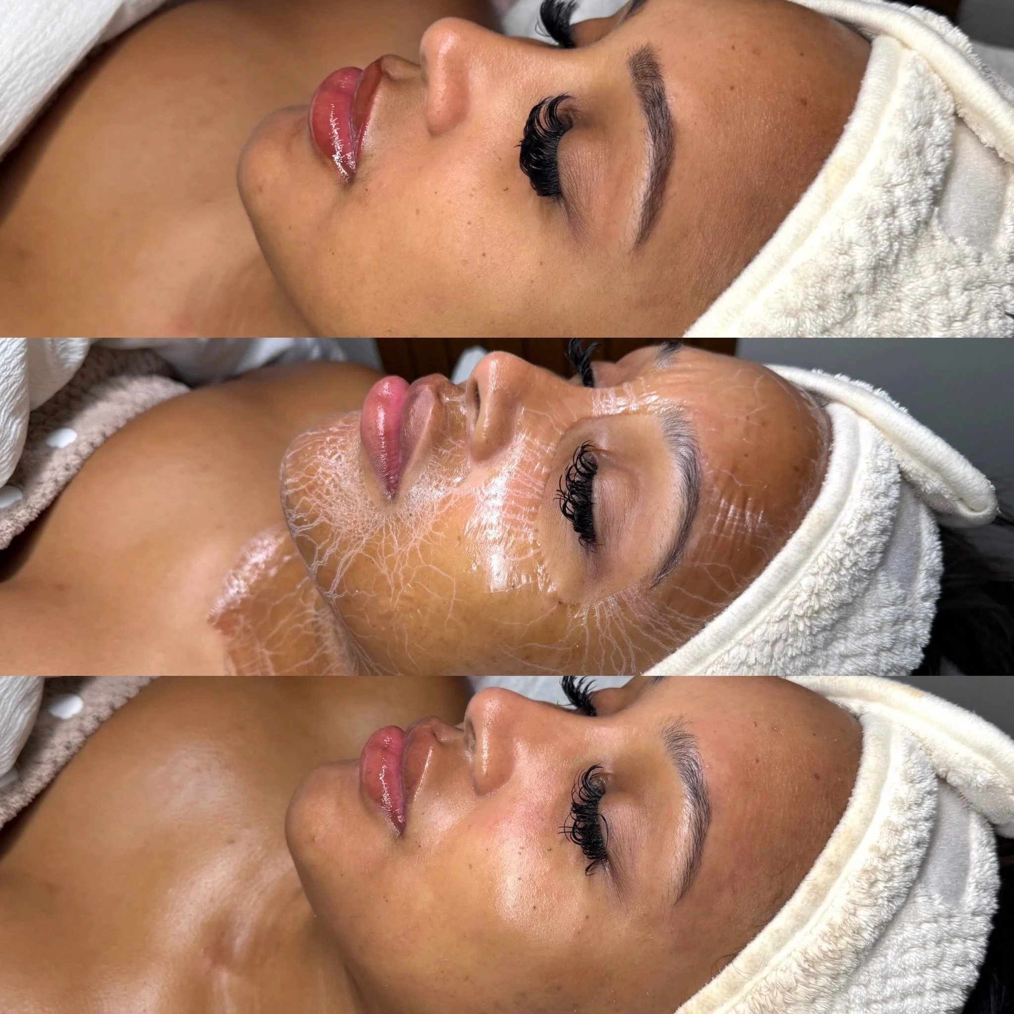 GlowTOX facial treatment ✨

Pre treatment ➡️ During treatment ➡️ Post Treatment 

One of my favorites for boosted firmness and overall glow 
Link in bio to book!