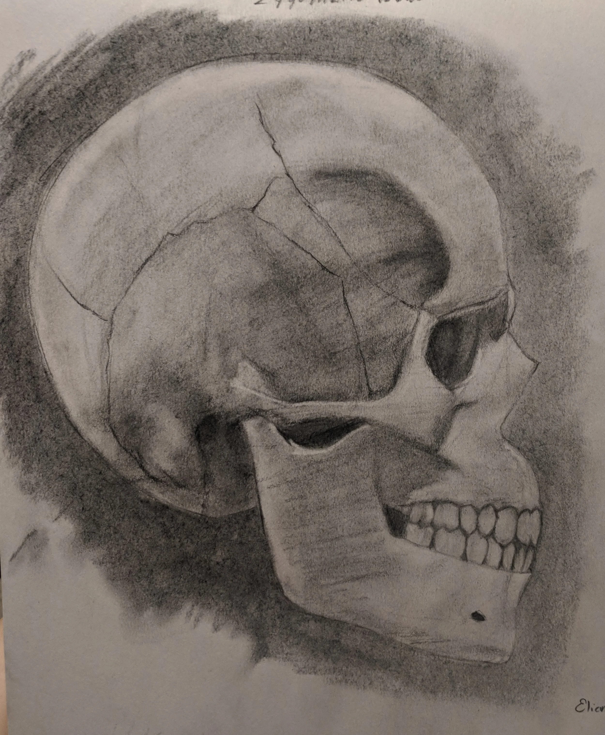 Zygomatic Bone Study