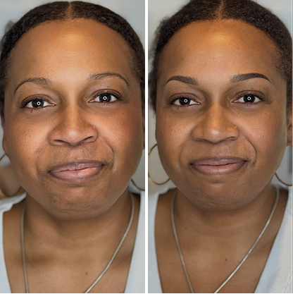 Side-by-side before and after photos of a woman with short curly hair, showing improvements in skin tone and eyebrow shape.