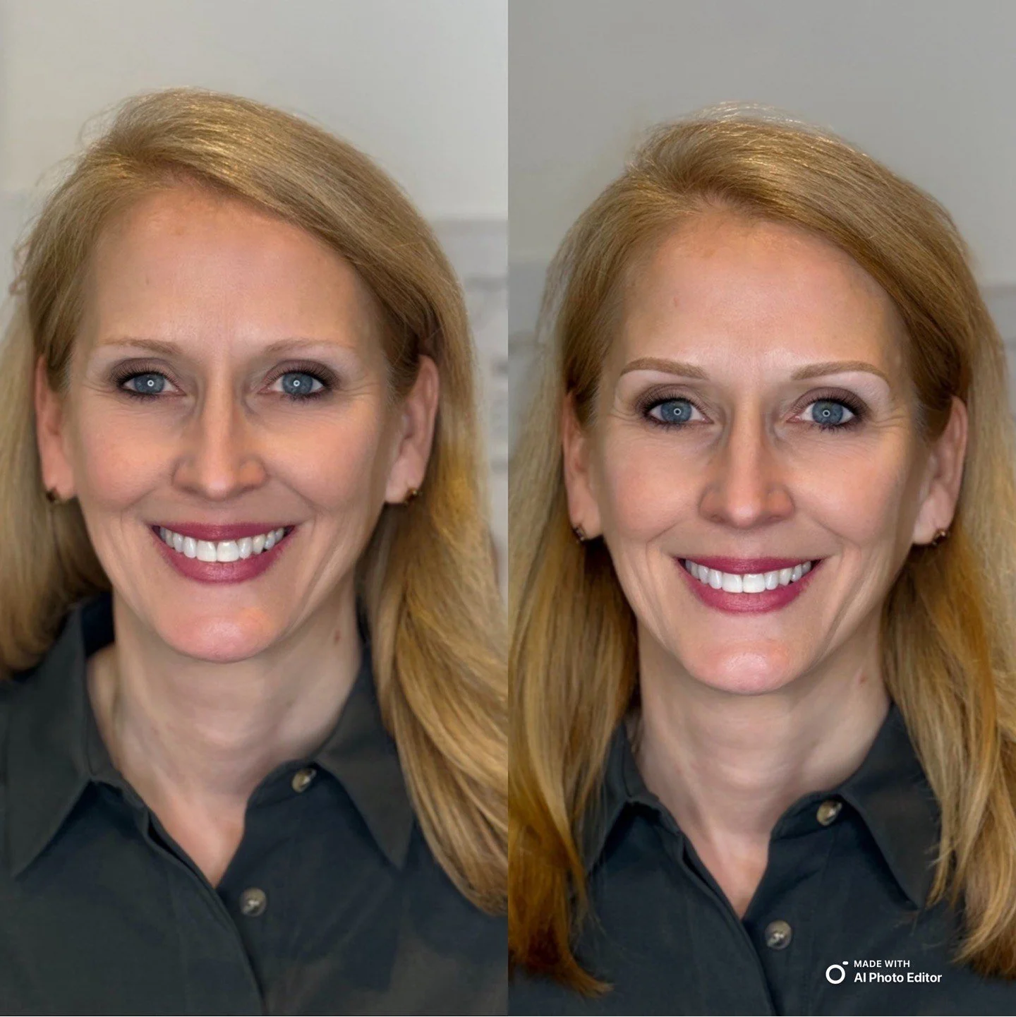 Side-by-side comparison of a woman with smiling, straight, white teeth, wearing a black collared shirt, light skin, blue eyes, and red hair. The left side shows her with makeup, and the right side shows her with a more natural look.