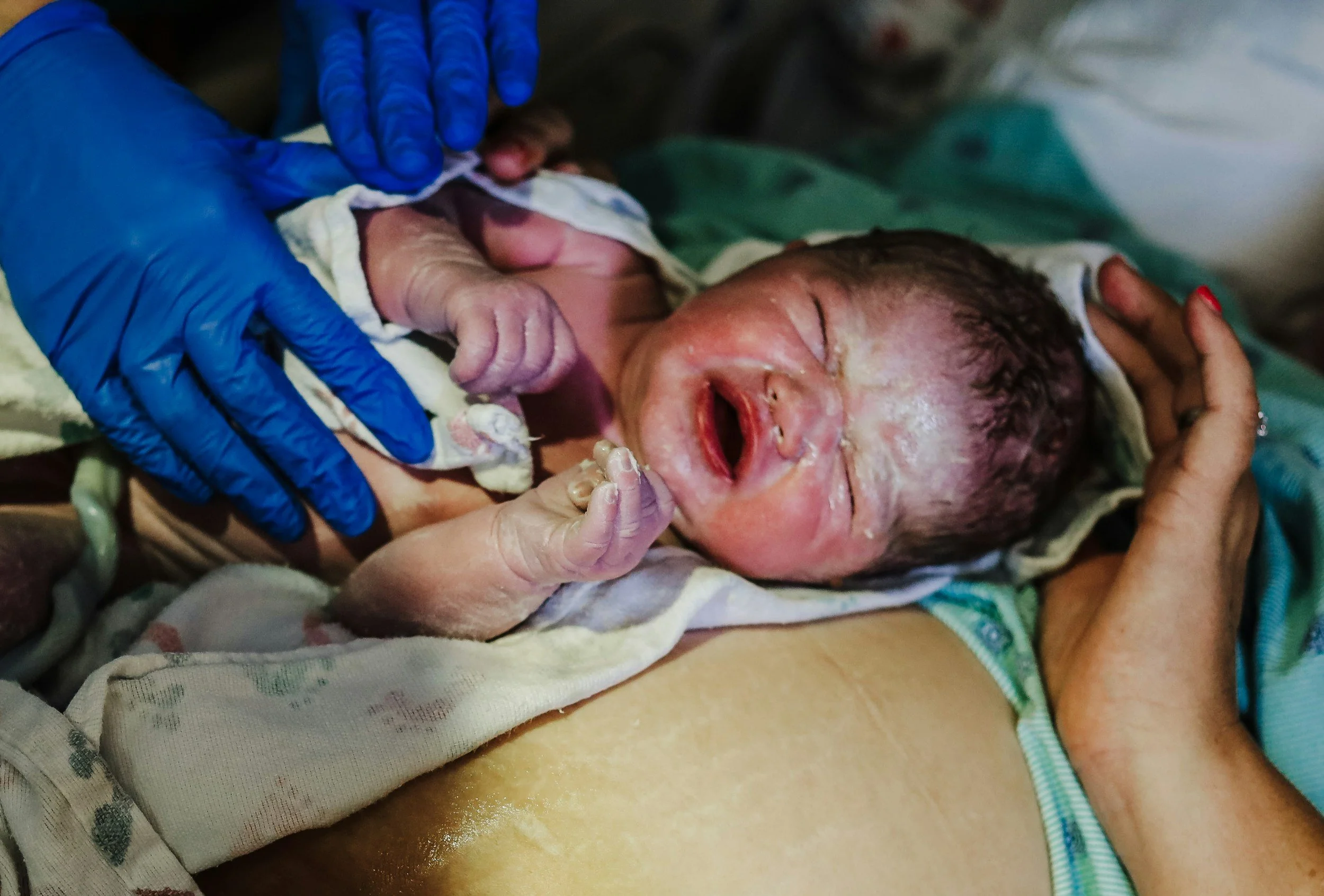 Newborn baby receiving medical care immediately after birth, with gloved hands supporting the infant.