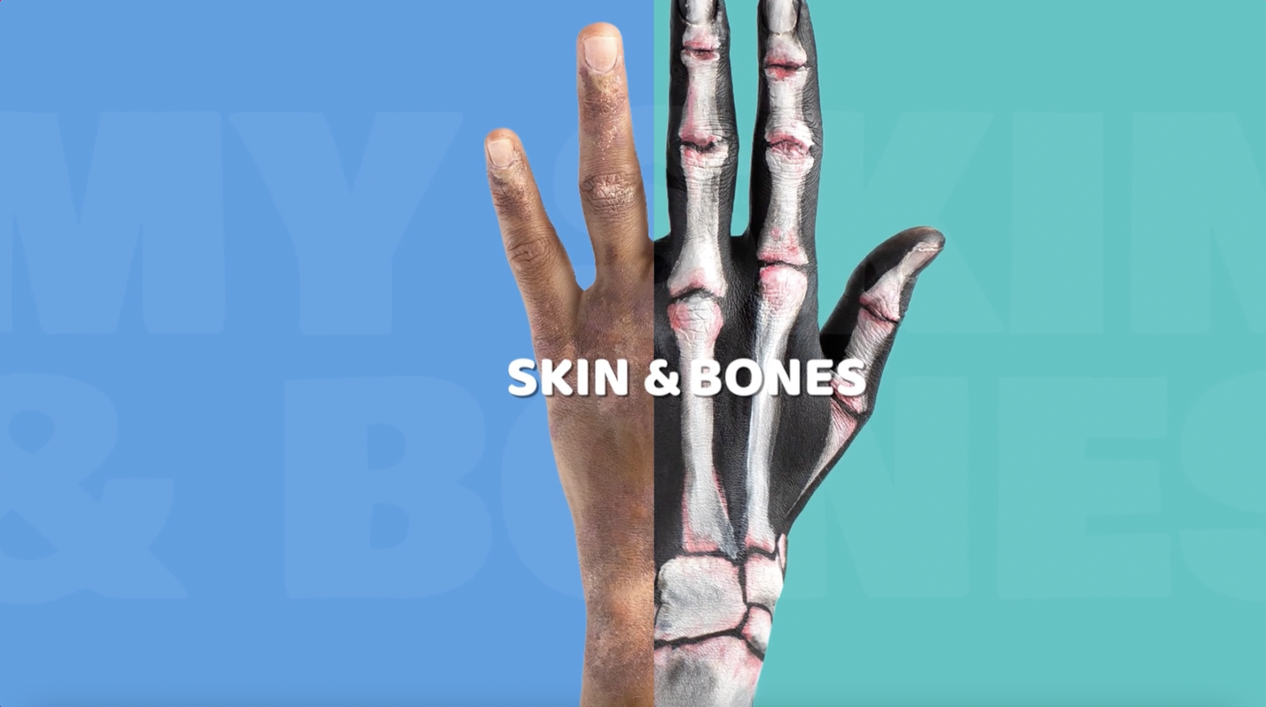 Novartis "My Skin and Bones"
